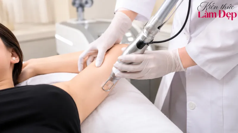 Có Nên Trị Thâm Body Bằng Deep L-Picosure Không?