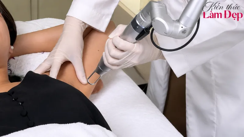 Deep L-Picosure – Công nghệ laser trị thâm thế hệ mới, chính xác và an toàn