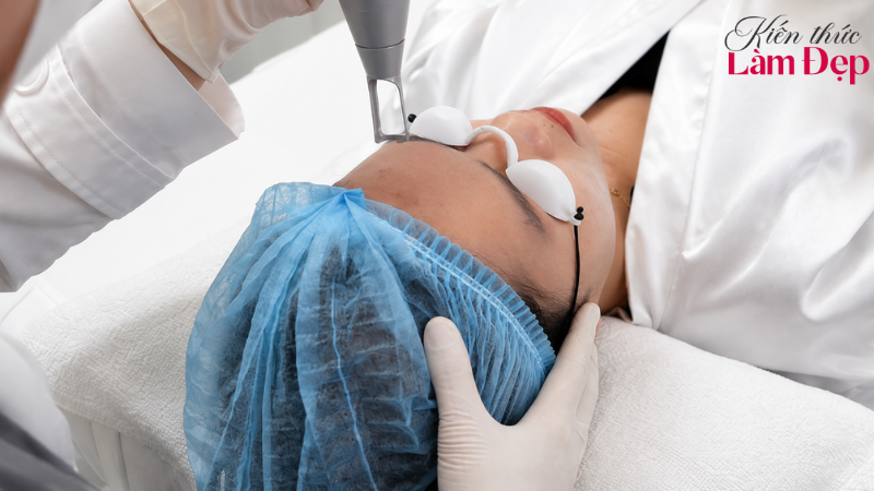 So Sánh Công Nghệ Deep L-Picosure Với Laser Q-Switched: Có Gì Khác Nhau?