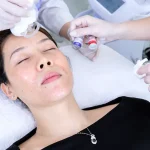 Biocell Plus: Công Nghệ Trị Nám Trẻ Hóa Nhanh Vượt Trội