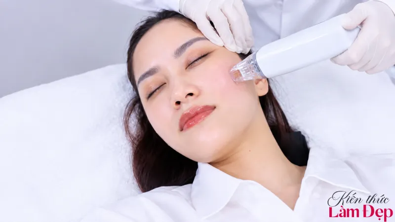 Số buổi thực hiện Biocell Plus thường tùy tình trạng nám