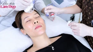 Biocell Plus: Công Nghệ Trị Nám Trẻ Hóa Nhanh Vượt Trội
