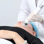Căng Da Không Phẫu Thuật – Công Nghệ 5.5.10: Giải Pháp Trẻ Hóa Da Toàn Diện