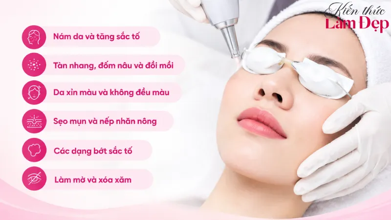 RevLite hỗ trợ cải thiện sắc tố, xỉn màu, sẹo, nếp nhăn, xóa xăm