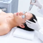 Mela Extra: Liệu Trình Đánh Bay Nám, Lấy Lại Làn Da Sáng Mịn 