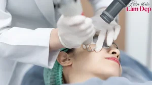 Nanocell Diamond: Công Nghệ Trị Nám Và Trẻ Hóa Da 5 Trong 1